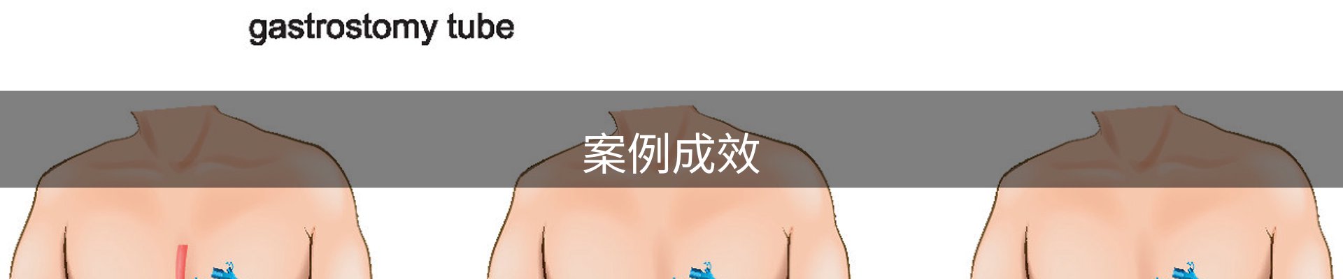案例成效